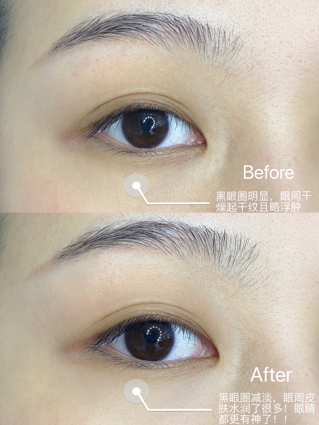 眼霜—Kerrykerry宝贝收到了，，，刚用肌肤嘟噜嘟噜的喝水，，用完之后脸明显变白了，，，，很喜欢